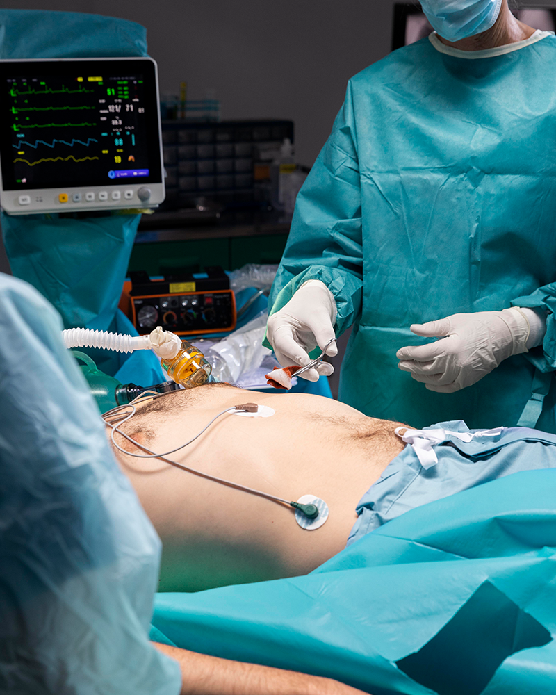 SmartLipo for Men