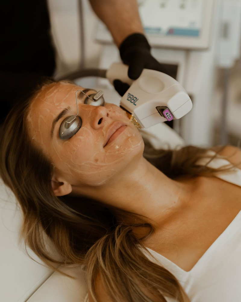 BBL Photofacial