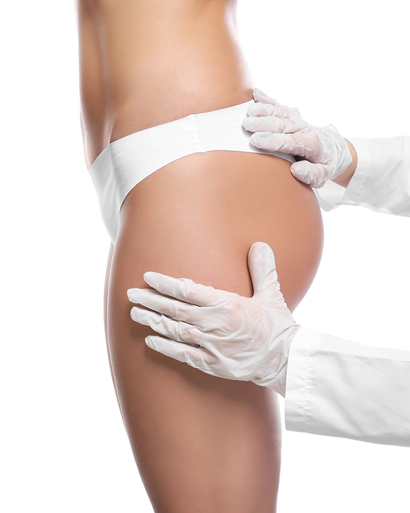 Brazilian Butt Lift