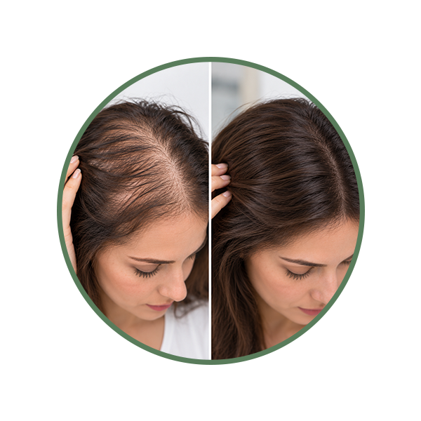 Thinning Hair