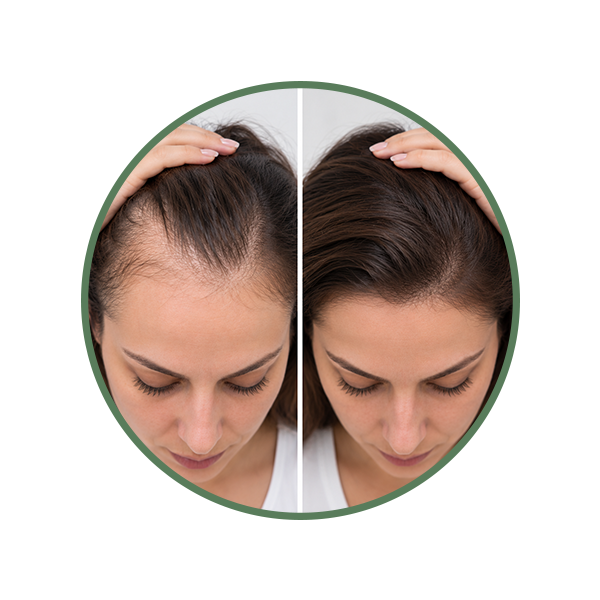 A Receding Hairline