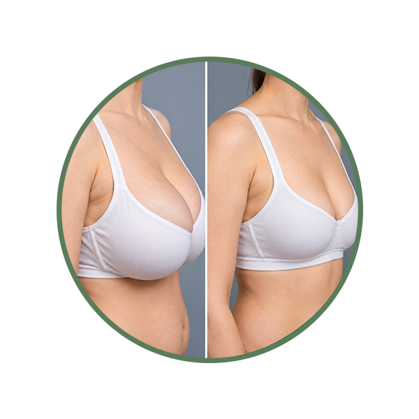 Minimize Surgical Intervention