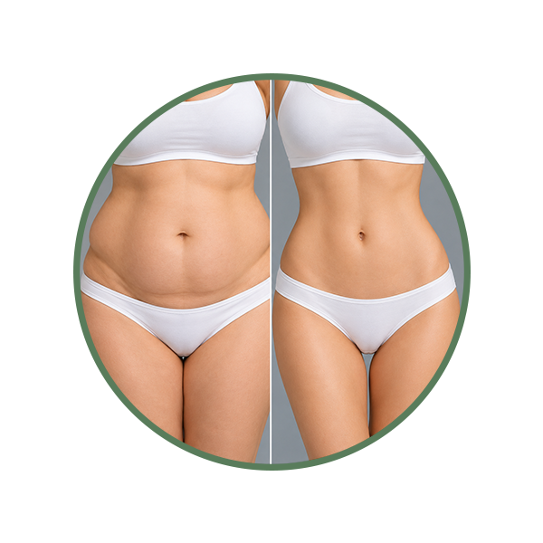 Body Contouring