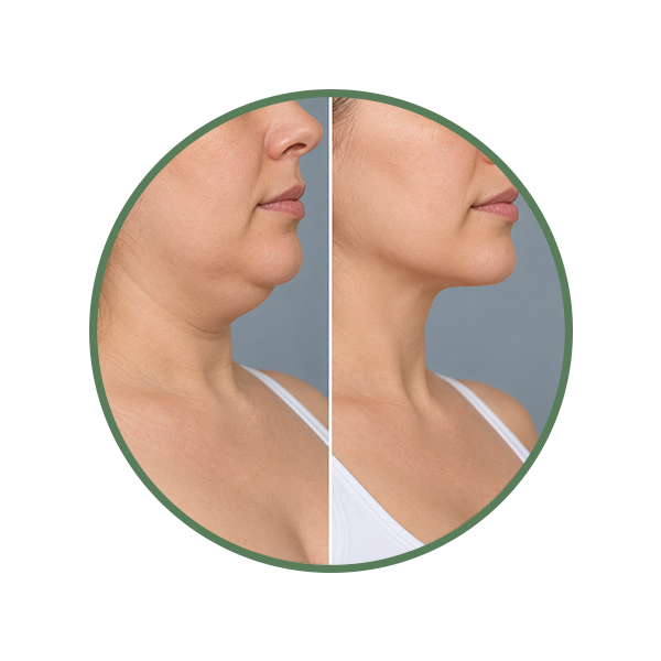 Neck & Chin