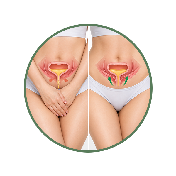 Urinary Incontinence