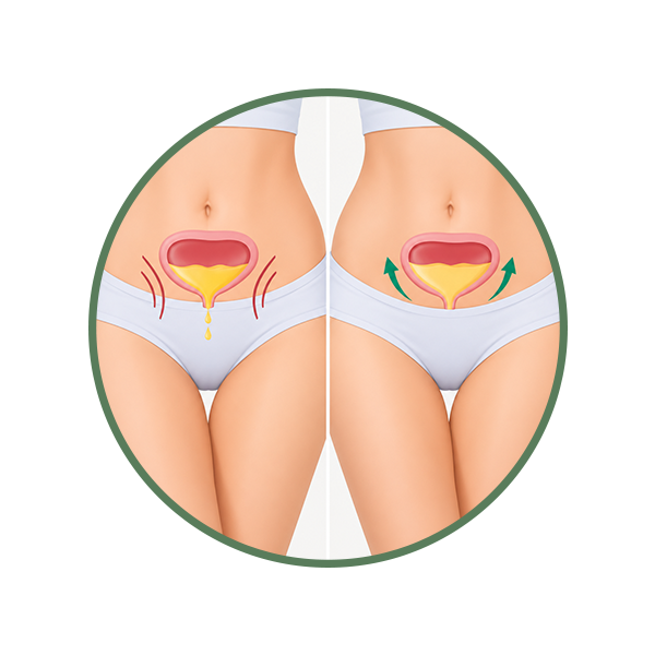 Urinary Incontinence