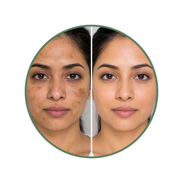 Uneven Tone & Dark Spots